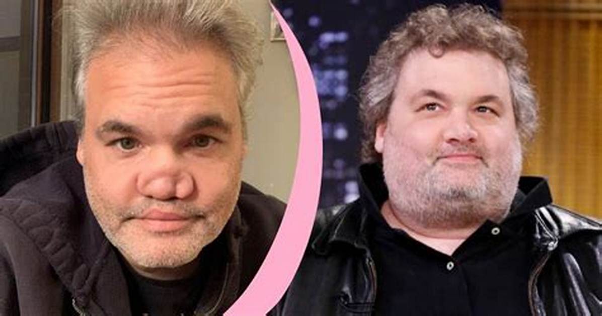 Artie Lange Nose: a Comprehensive Look at His Journey and Transformation