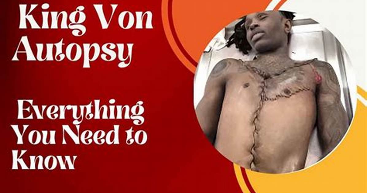 Autopsy of King Von: an in-Depth Analysis of His Life and Untimely Death