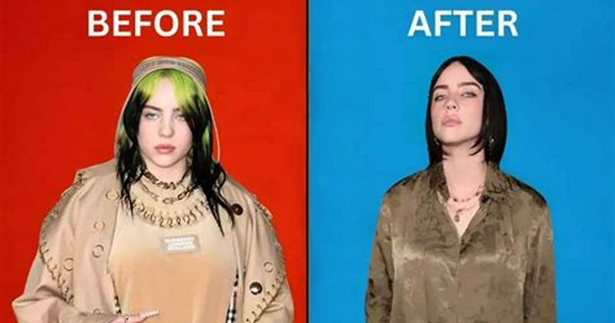 Billie Eilish Breast Reduction: a Journey Towards Self-Acceptance