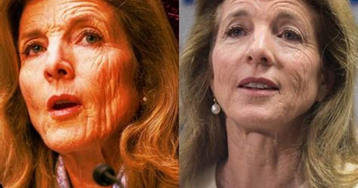 Caroline Kennedy Wrinkles: What You Need to Know & Why