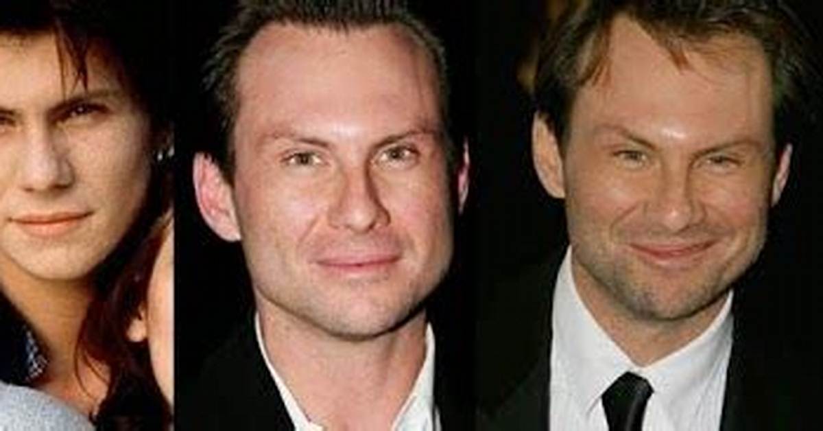 Christian Slater Botox: the Truth Behind the Transformation