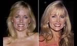 Dian Parkinson: the Life and Career of a Renowned Model and Actress