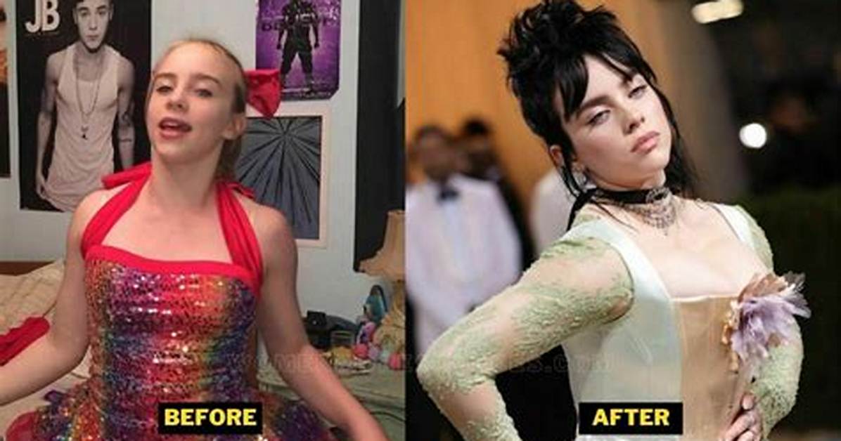 Did Billie Eilish Have Breast Reduction? a Comprehensive Analysis