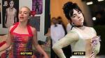 Did Billie Eilish Have Breast Reduction? a Comprehensive Analysis