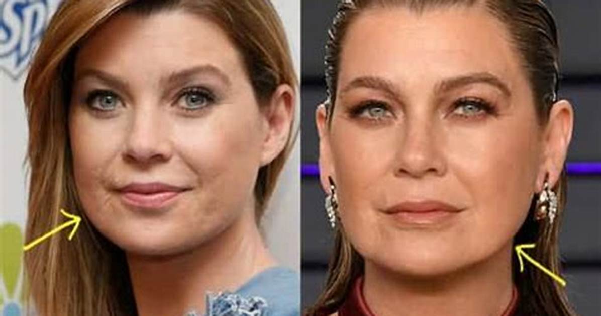 Ellen Pompeo Scars: a Journey Through Challenges and Triumphs