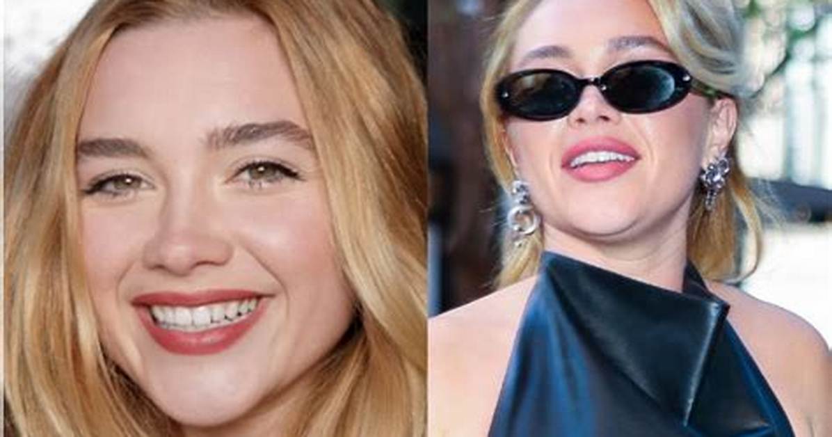 Florence Pugh Lip Filler: the Transformation of a Rising Star
