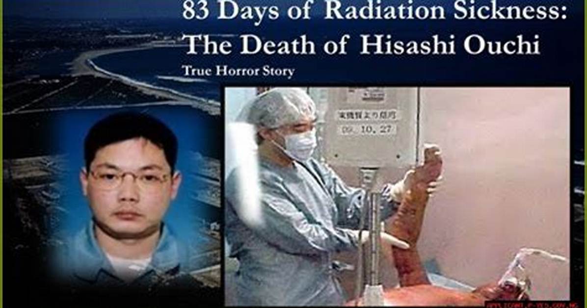 Hisashi Ouchi Real Photo: Understanding the Tragic Story Behind the Image