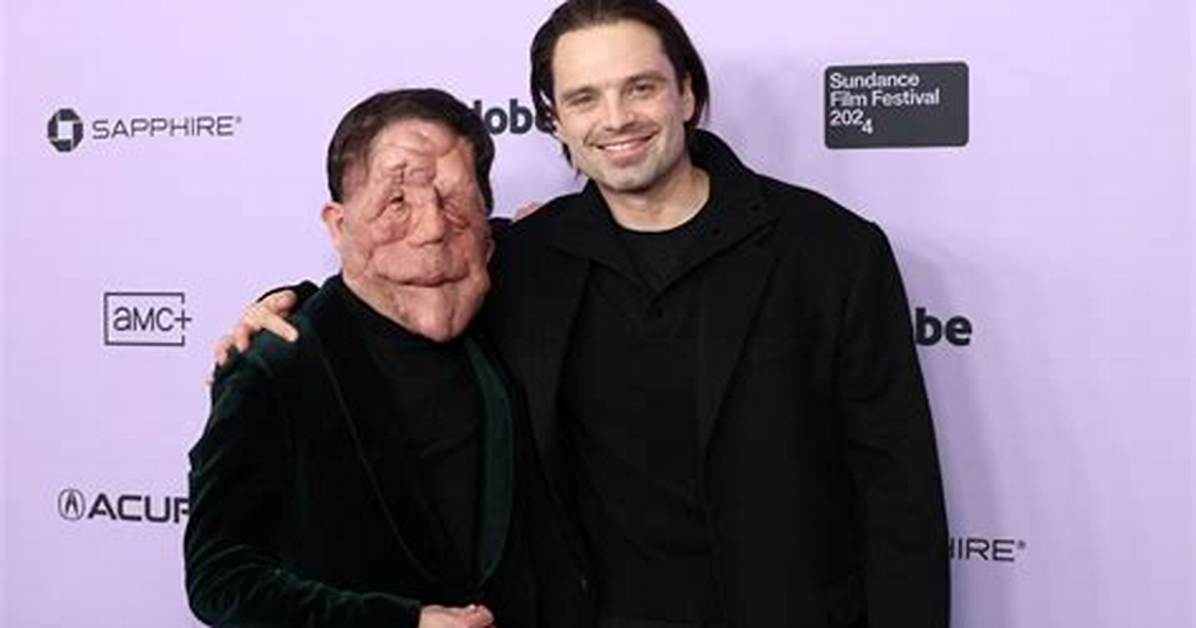 Is Adam Pearson Married? Exploring the Life of a Remarkable Individual