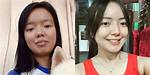 Rosmar Tan's Plastic Surgery Journey Explored