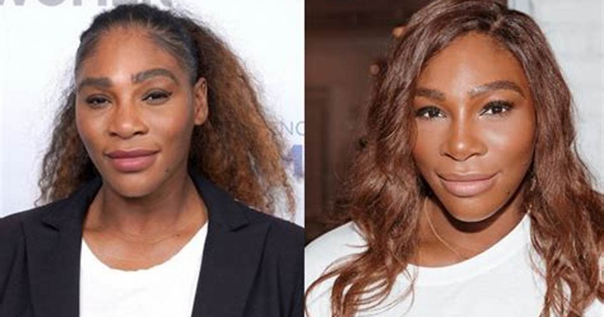 Serena Williams Plastic Surgery: Unveiling the Truth Behind the Rumors