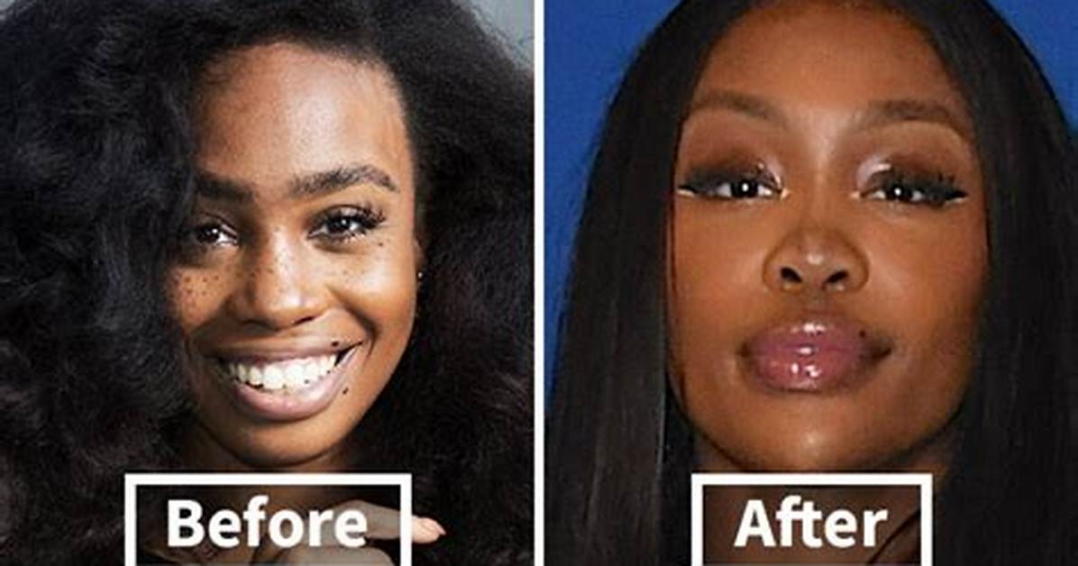 Sza Nose Job: the Truth Behind the Rumors and Transformations