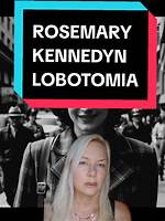 The Kennedy Lobotomy: a Controversial Chapter in Medical History