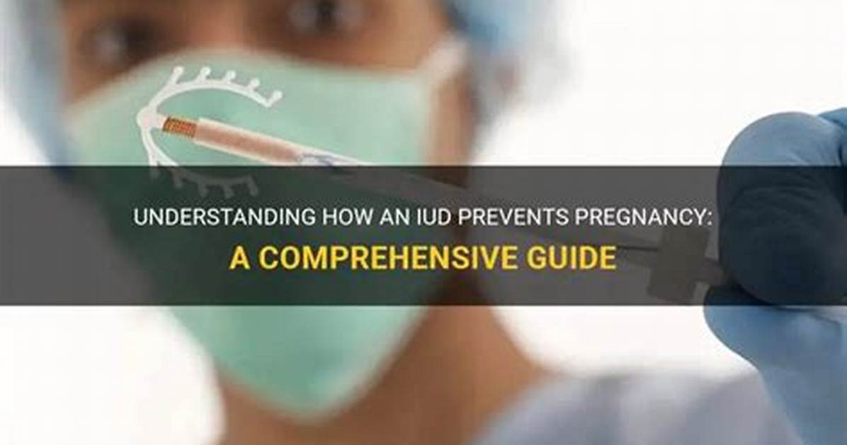 Understanding Baby Holding Iud: a Comprehensive Guide