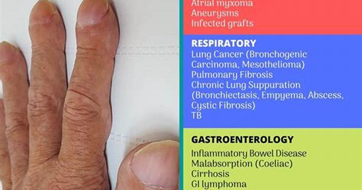 Understanding Clubitis Disease Symptoms in Adults: a Comprehensive Guide