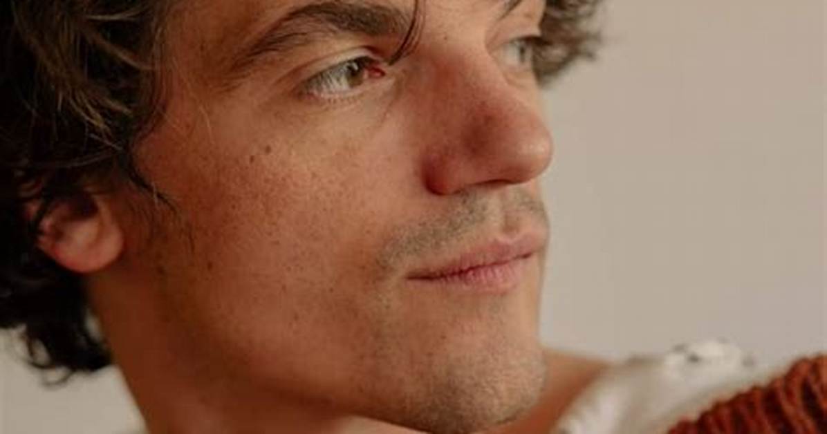Understanding Edward Bluemel's Face Condition: a Deep Dive into His Journey