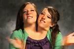 Understanding the Life and Journey of Conjoined Twin Abby Hensel