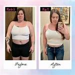 Wegovy Before and After: Transformations, Benefits, and Insights