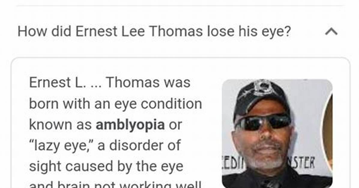 What Happened to Ernest Lee Thomas Eye? Net Worth, Wife |