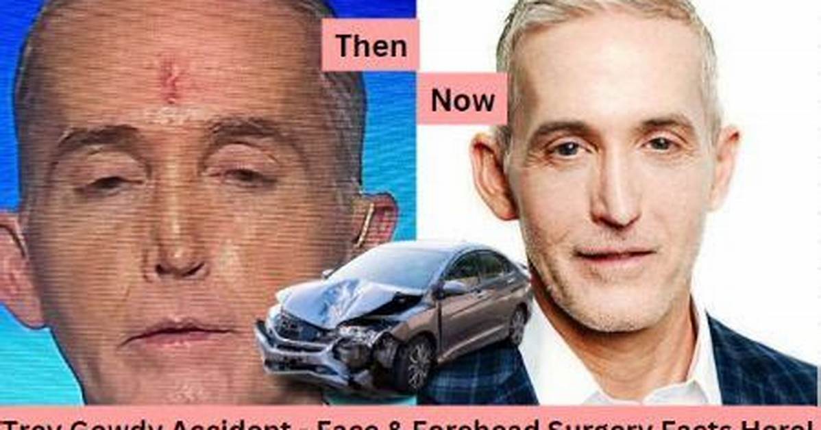 What Happened to Trey Gowdy's Nose? Unraveling the Mystery